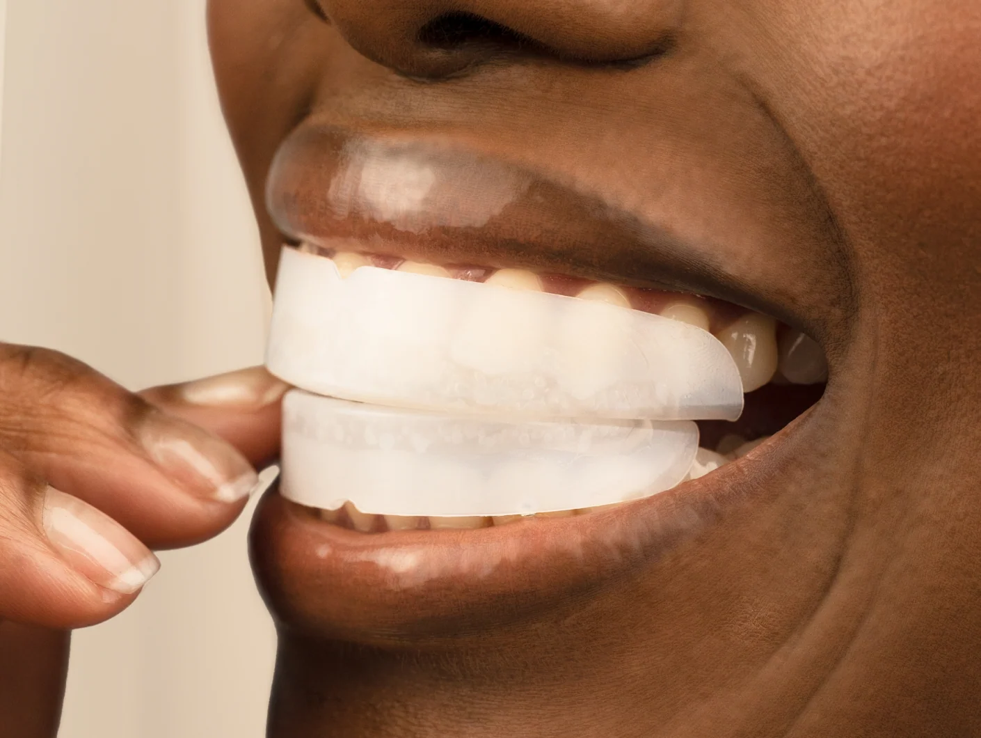 Prefilled Whitening Trays 3 pack Refill - Image 3